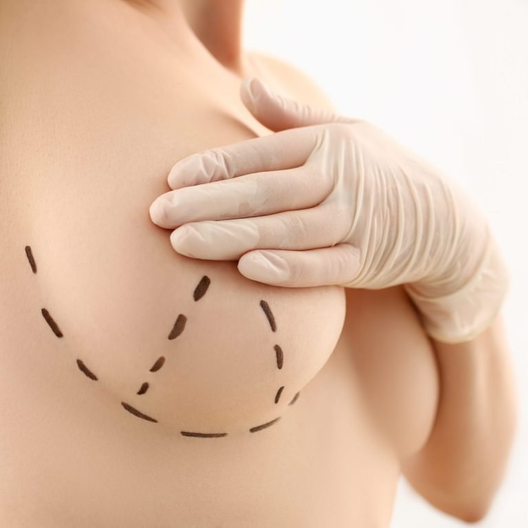 Female hand in gloves holding breast closeup on doctor mammology clinic reception. Mammary glands test biopsy implant silicone insert tumor human concept